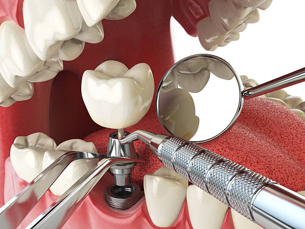 Best Emergency Dental Care for Broken or Chipped Teeth in Garland, NC